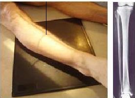 Proyección AP Pierna